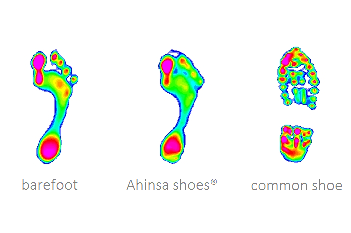 plantar-pressure-measurements-scaled-en