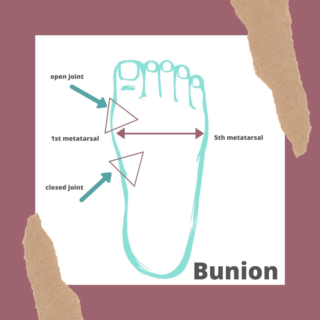 12 Best Shoe Brands for Bunions Bare Soled Girl